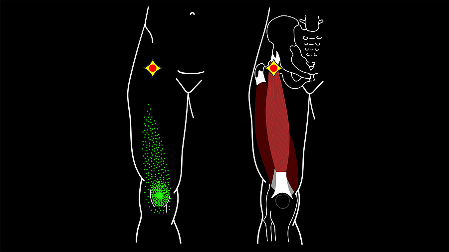 Muscle Knot Pain Managing It The Natural Way Advanced Spinal Care